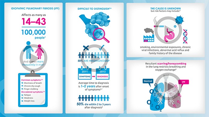 IPF Video Infographic