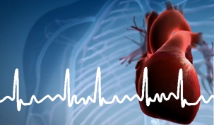 Stroke Prevention in AF