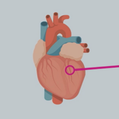 animation